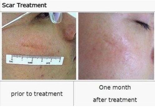 Trucco per occhi marroni e lentiggini di una fotografia
